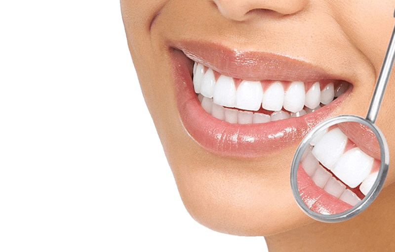 Эстетическая реставрация зуба с помощью винира в CityClinic